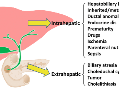 Hekimler için-Kolestaz ve metabolik&nbsp;hastalıklar
